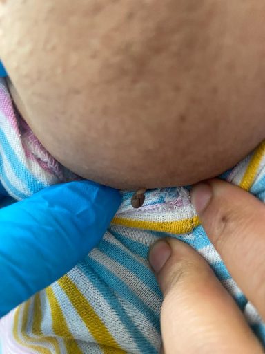 A close-up of a hand gently pointing at a small object on a striped garment.